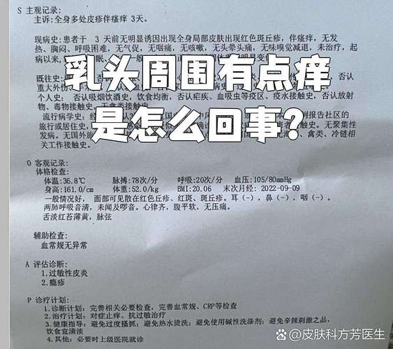怀孕期乳头痒是正常反应还是疾病信号？该怎么缓解才安全？-第1张图片-郑州医学网