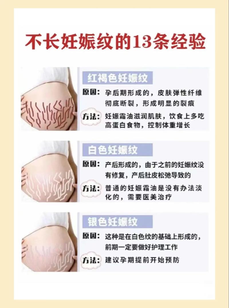 孕期如何科学有效减少妊娠纹?这些方法真的靠谱吗?-第2张图片-郑州医学网 孕期如何科学有效减少妊娠纹?这些方法真的靠谱吗?-第2张图片-郑州医学网