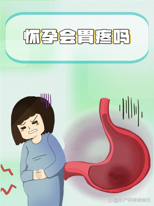 怀孕期胃疼影响胎儿吗-第2张图片-郑州医学网