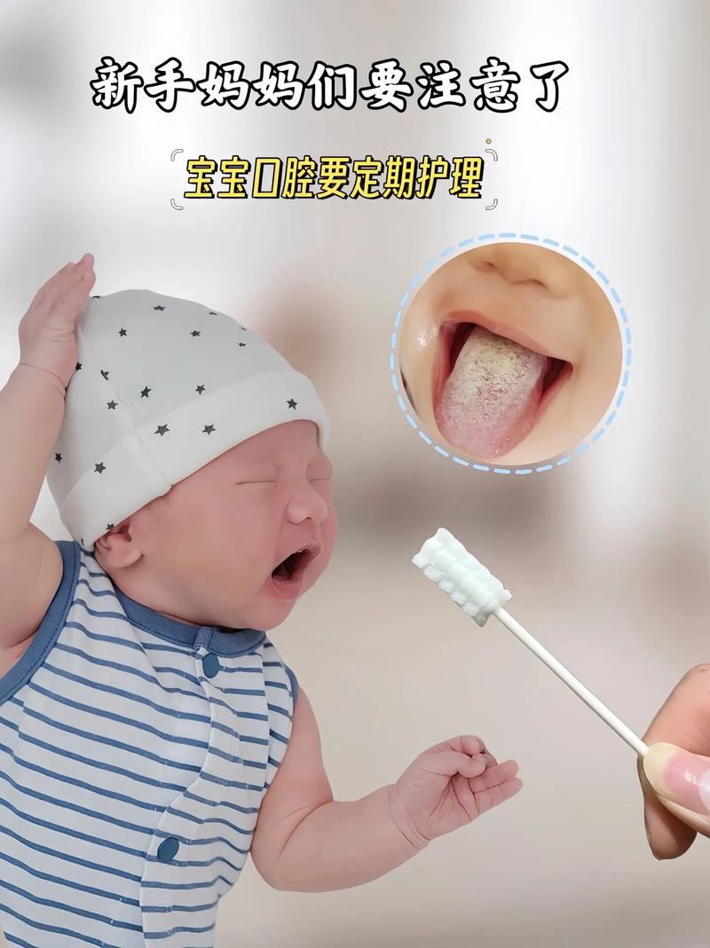 新生儿喝奶粉后舌头发白是正常现象还是健康问题?-第2张图片-郑州医学网 新生儿喝奶粉后舌头发白是正常现象还是健康问题?-第2张图片-郑州医学网