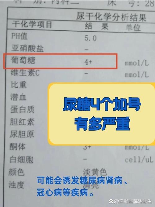 孕期尿葡萄糖1个加号需要立即干预吗？对胎儿发育有影响吗？-第1张图片-郑州医学网