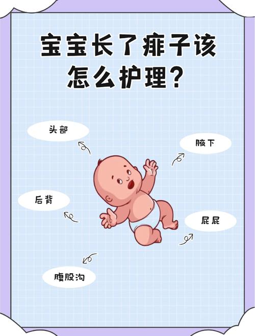 新生儿卤门受凉到底会有哪些严重危害？家长该如何正确护理？-第1张图片-郑州医学网