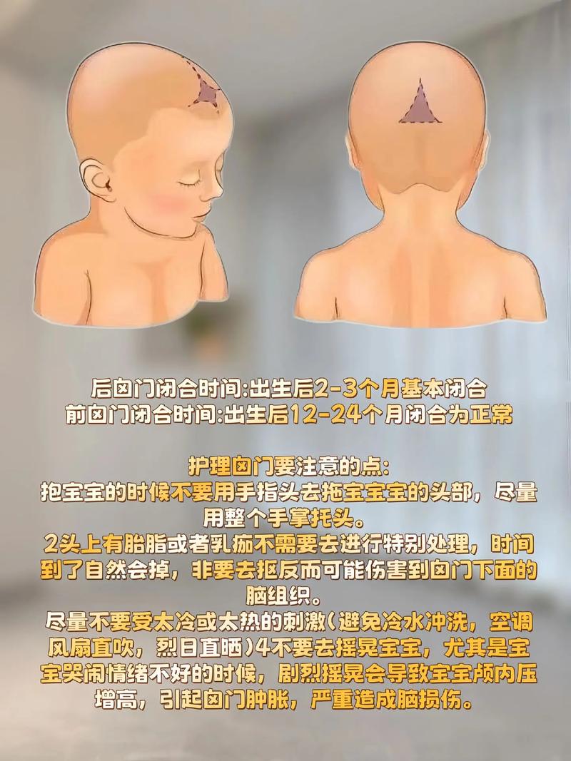 新生儿卤门受凉到底会有哪些严重危害？家长该如何正确护理？-第3张图片-郑州医学网