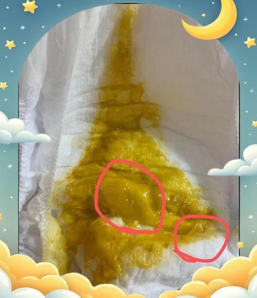 新生儿出生时身上有粘液是正常现象吗？需要清理吗？会对呼吸有影响吗？-第3张图片-郑州医学网