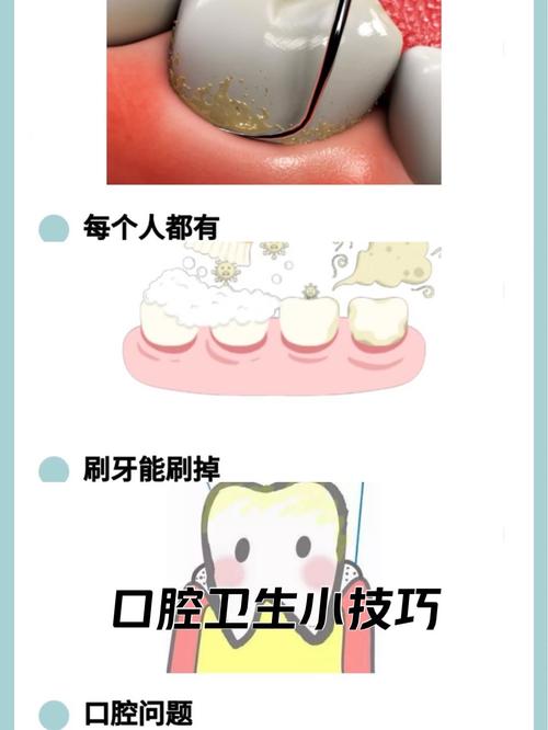 儿童牙齿黑斑是什么原因导致的?有哪些安全有效的去除方法?-第3张图片-郑州医学网 儿童牙齿黑斑是什么原因导致的?有哪些安全有效的去除方法?-第3张图片-郑州医学网