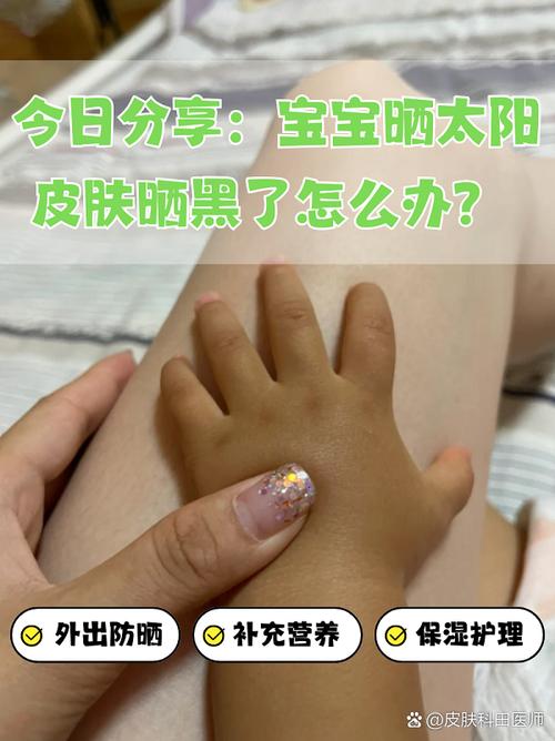 新生儿晒太阳会变黑吗?科学解答肤色变化与正确晒太阳方法-第1张图片-郑州医学网 新生儿晒太阳会变黑吗?科学解答肤色变化与正确晒太阳方法-第1张图片-郑州医学网