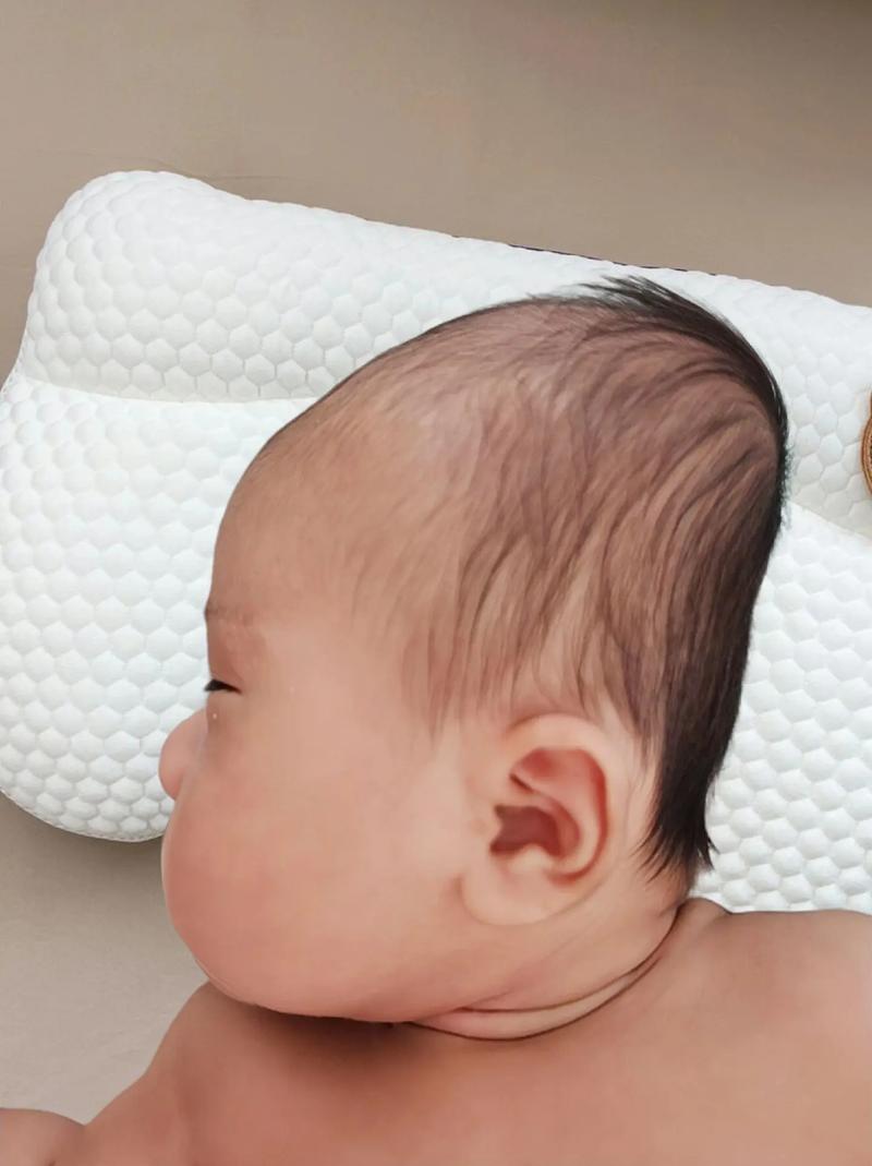 新生儿睡头型,崔玉涛怎么看?科学矫正还是自然生长?-第1张图片-郑州医学网 新生儿睡头型,崔玉涛怎么看?科学矫正还是自然生长?-第1张图片-郑州医学网