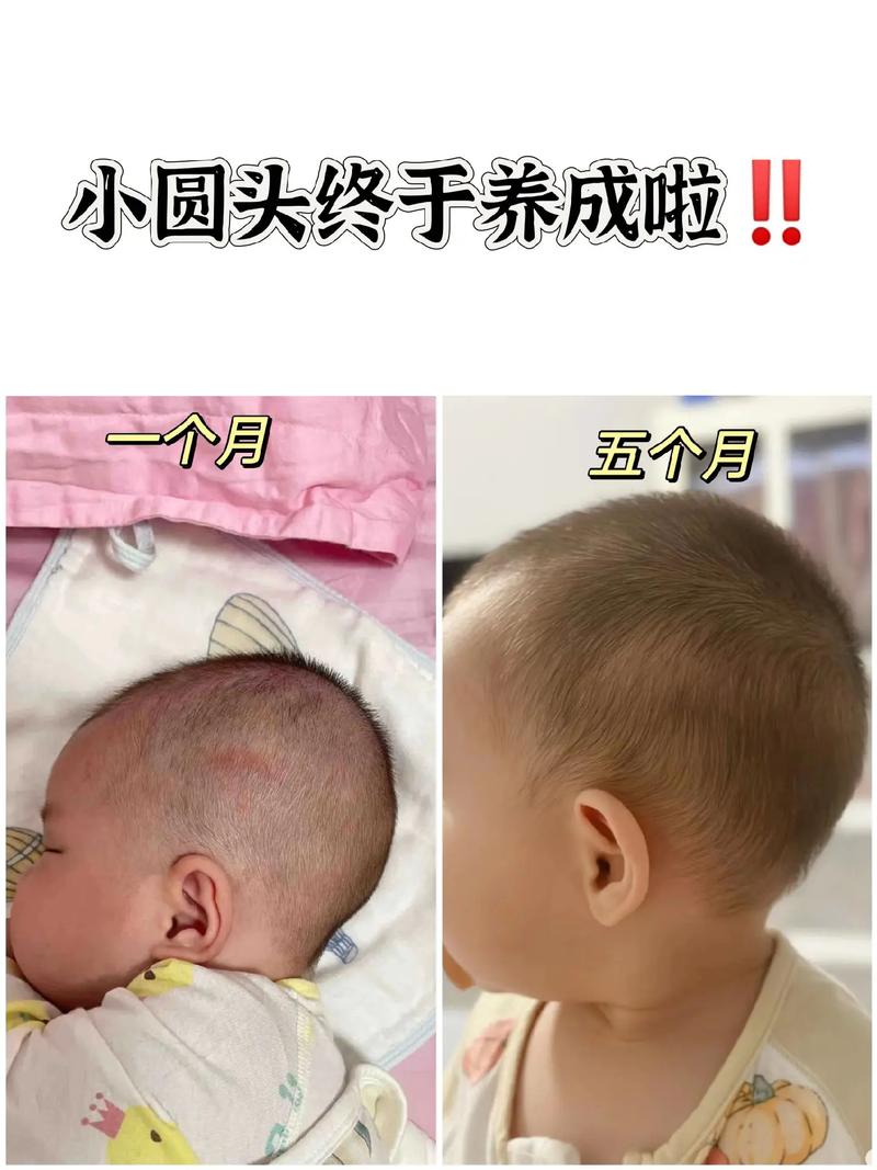 新生儿睡头型,崔玉涛怎么看?科学矫正还是自然生长?-第3张图片-郑州医学网 新生儿睡头型,崔玉涛怎么看?科学矫正还是自然生长?-第3张图片-郑州医学网