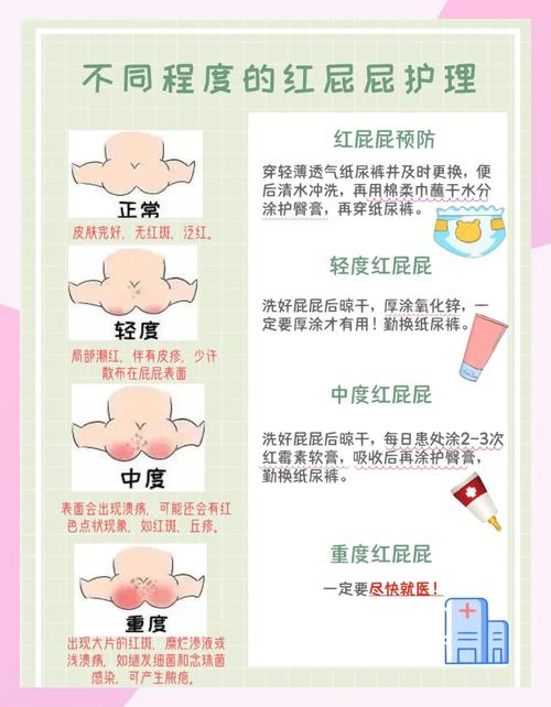 女新生儿私处发红图片是正常现象吗?需要就医处理吗?-第3张图片-郑州医学网 女新生儿私处发红图片是正常现象吗?需要就医处理吗?-第3张图片-郑州医学网