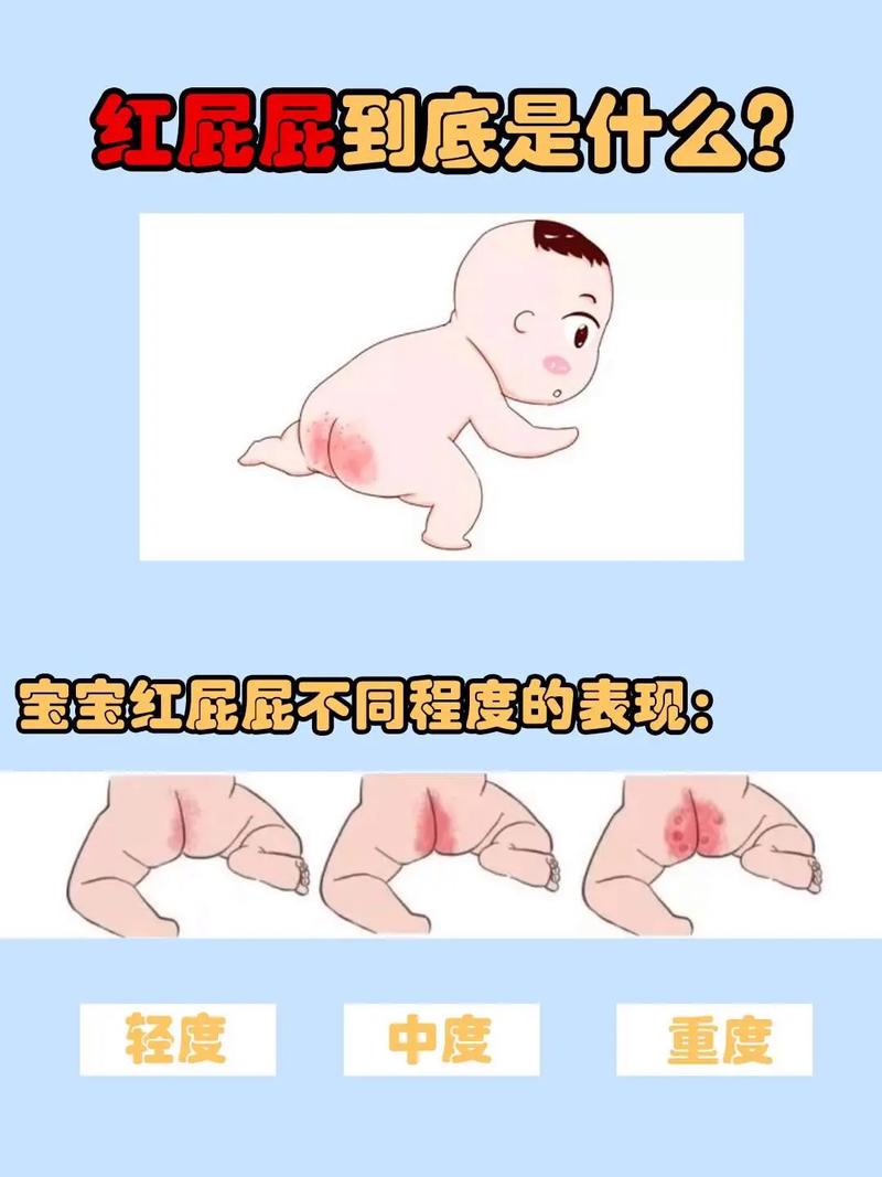 新生儿皮肤红得像小苹果，到底正常还是生病信号？-第2张图片-郑州医学网