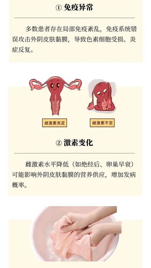 孕期外阴瘙痒难忍？究竟是什么原因导致的？又该如何安全有效缓解呢？-第2张图片-郑州医学网
