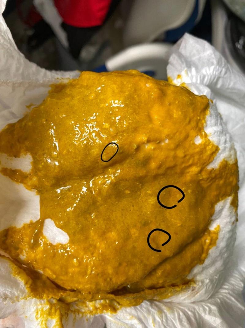 新生儿粑粑里有奶瓣是消化不良还是正常现象？-第2张图片-郑州医学网