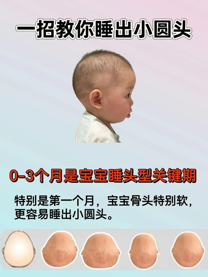 新生儿头颅多久能自然变圆？不同睡姿会影响头型吗？-第1张图片-郑州医学网