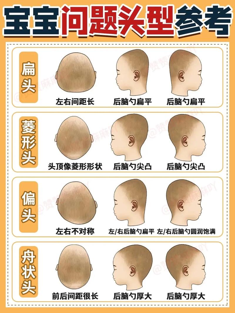 新生儿头颅多久能自然变圆？不同睡姿会影响头型吗？-第2张图片-郑州医学网