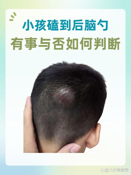 新生儿碰到头有没有事-第1张图片-郑州医学网