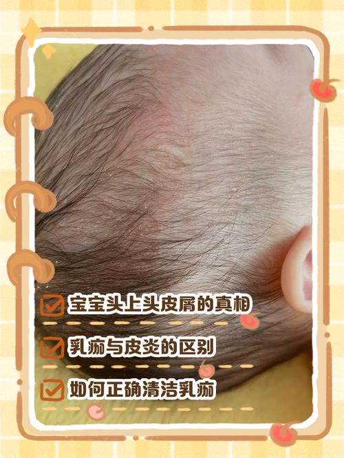 新生儿碰到头有没有事-第3张图片-郑州医学网