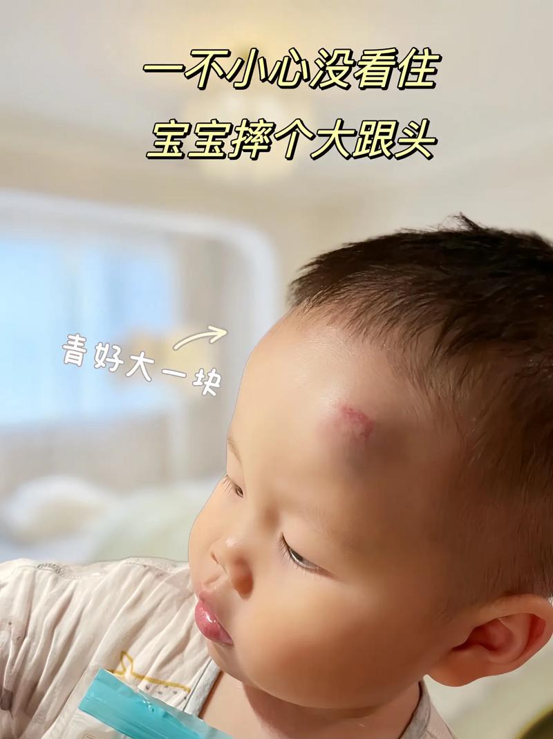 新生儿碰到头有没有事-第2张图片-郑州医学网