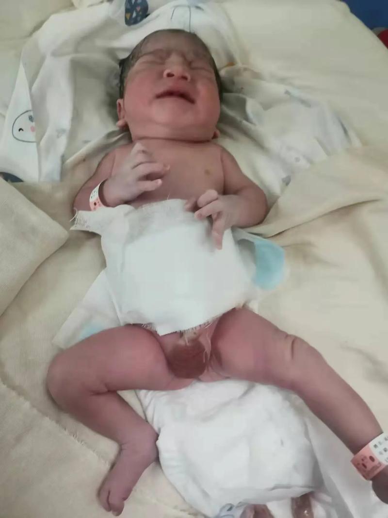 新生儿小蛋蛋发黑是正常现象吗？需要担心哪些健康问题？-第1张图片-郑州医学网