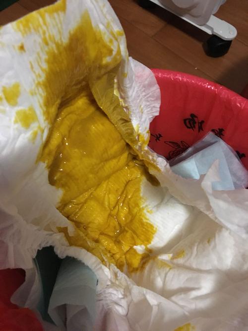 新生儿吃母乳就拉肚子，是母乳问题还是宝宝肠道不适应？-第1张图片-郑州医学网