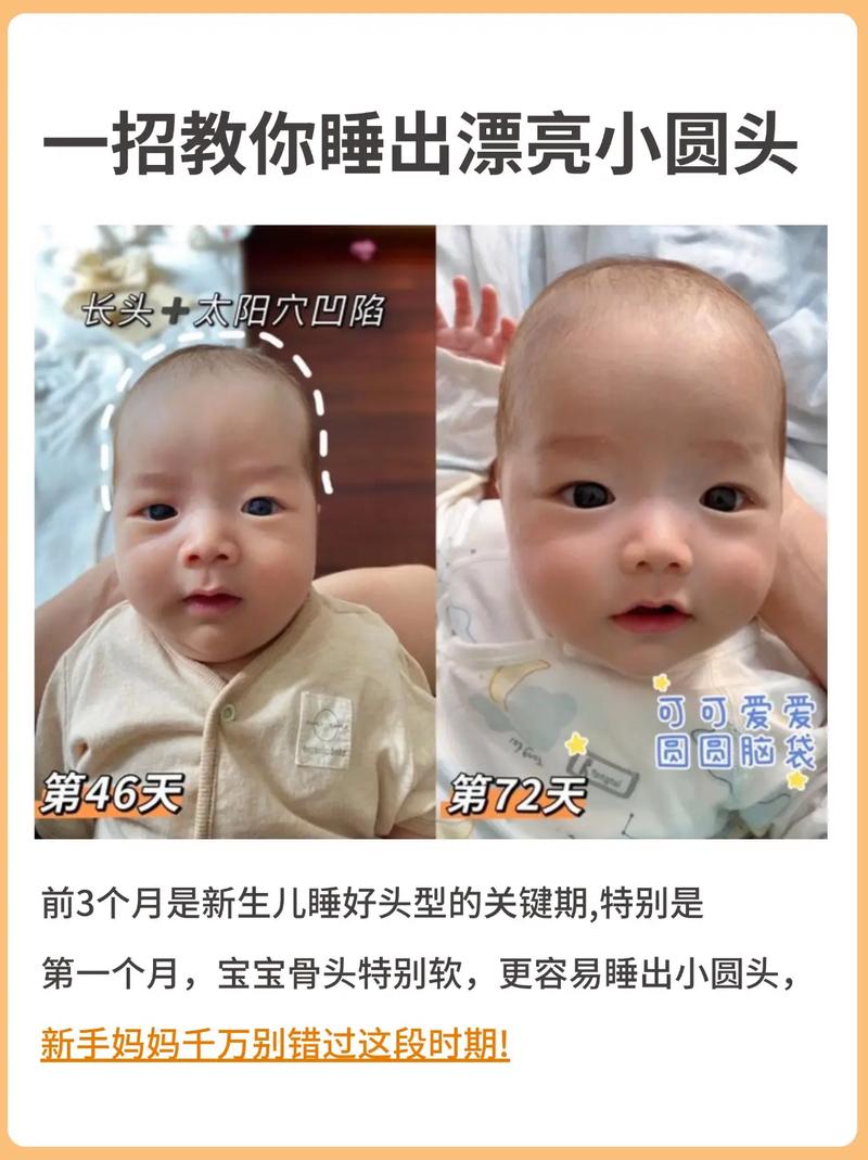 新生儿头大身子小正常吗?图片中的发育情况需要关注吗?-第1张图片-郑州医学网 新生儿头大身子小正常吗?图片中的发育情况需要关注吗?-第1张图片-郑州医学网