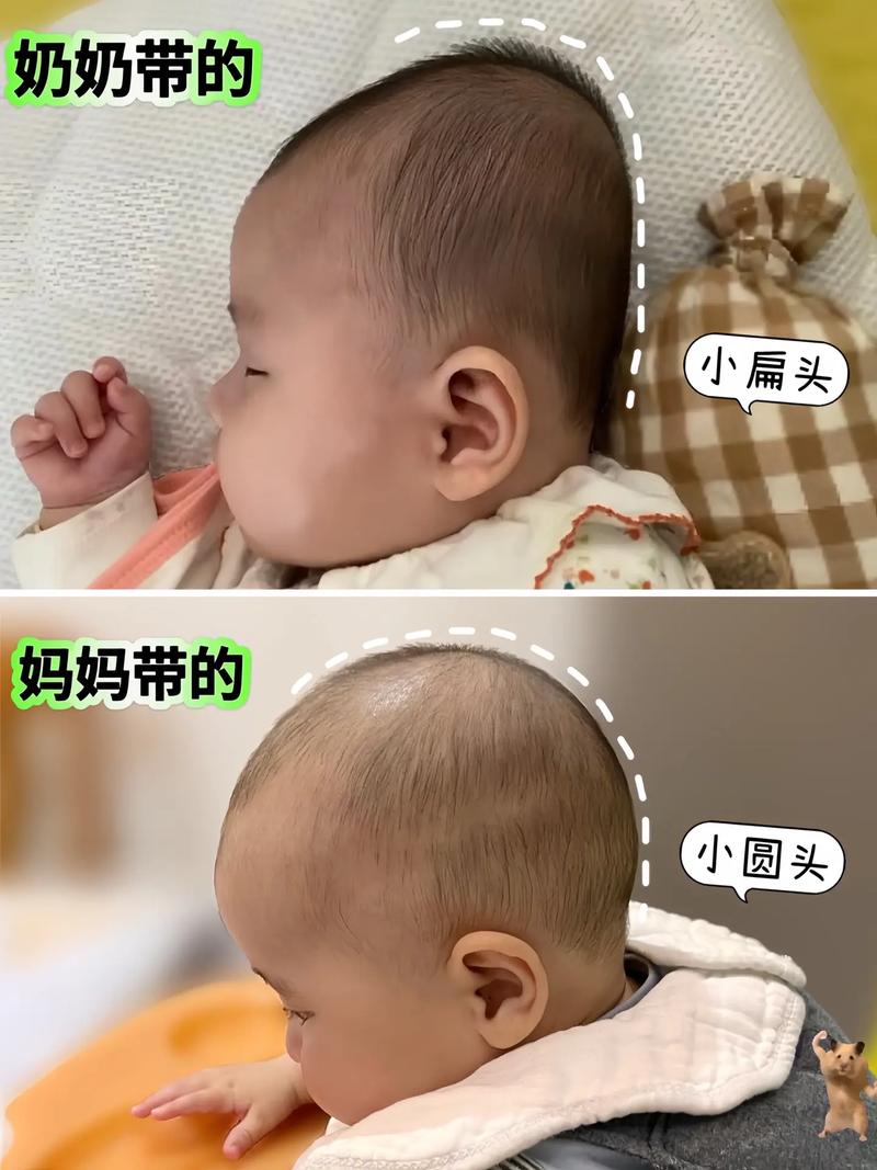 新生儿头大身子小正常吗?图片中的发育情况需要关注吗?-第3张图片-郑州医学网 新生儿头大身子小正常吗?图片中的发育情况需要关注吗?-第3张图片-郑州医学网