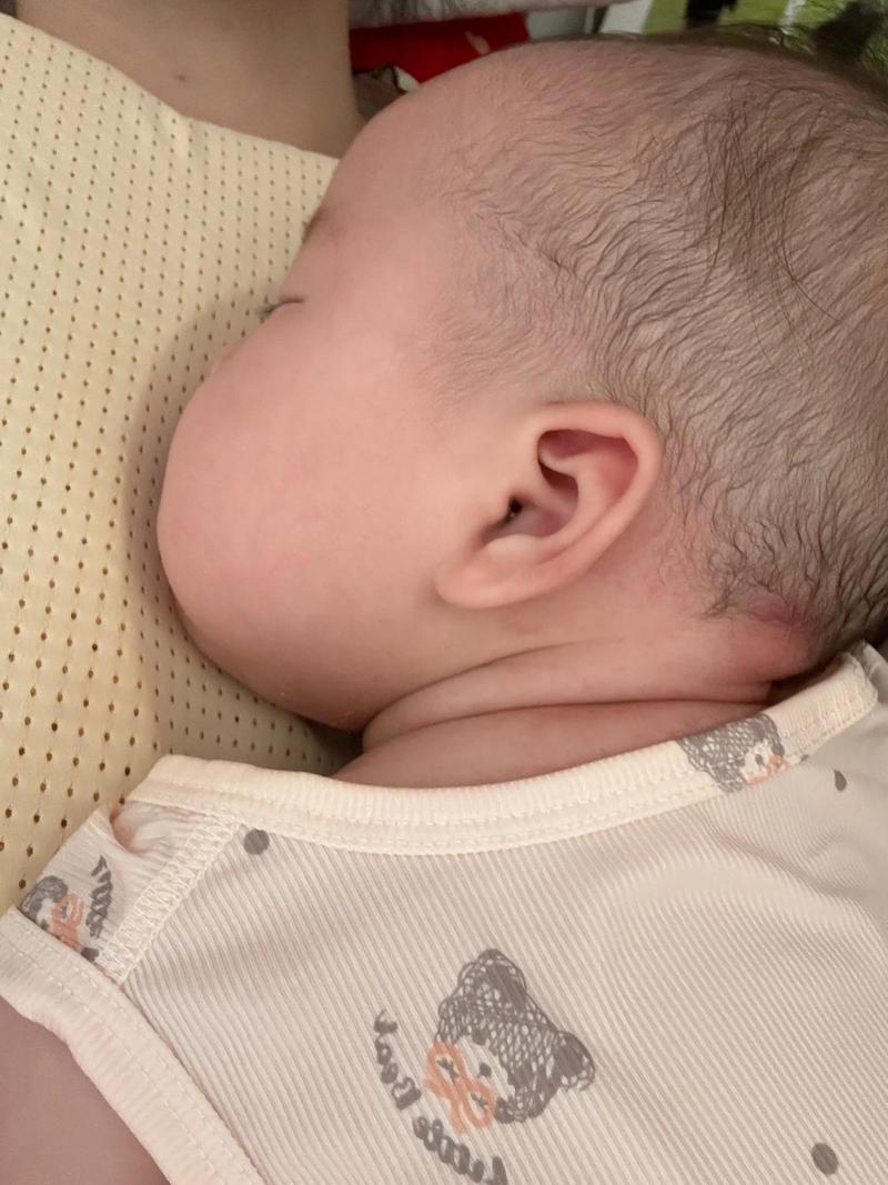 新生儿大小脸不对称会自然恢复吗?需要干预吗?-第2张图片-郑州医学网 新生儿大小脸不对称会自然恢复吗?需要干预吗?-第2张图片-郑州医学网