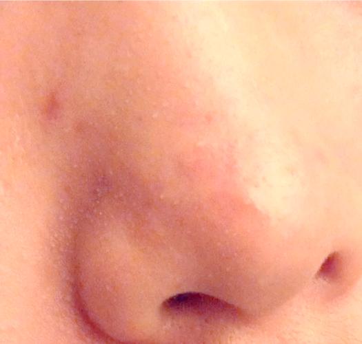 怀孕期间鼻子特别敏感，是激素变化捣的鬼吗？-第1张图片-郑州医学网