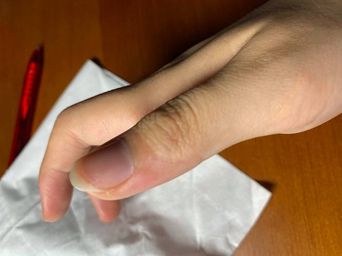 孕期阴唇瘙痒能用盐水清洗吗？这样处理会加重症状还是有助缓解？-第1张图片-郑州医学网