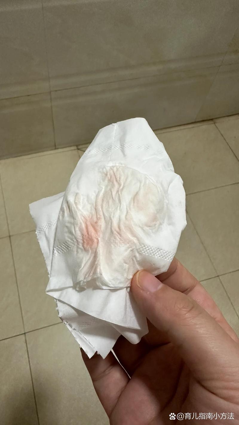 孕期流鲜红的血却没有腹痛,这是怎么回事?会对宝宝有危险吗?-第2张图片-郑州医学网 孕期流鲜红的血却没有腹痛,这是怎么回事?会对宝宝有危险吗?-第2张图片-郑州医学网