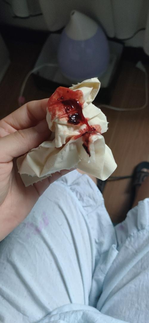 孕期流鲜红的血却没有腹痛，这是怎么回事？会对宝宝有危险吗？-第3张图片-郑州医学网