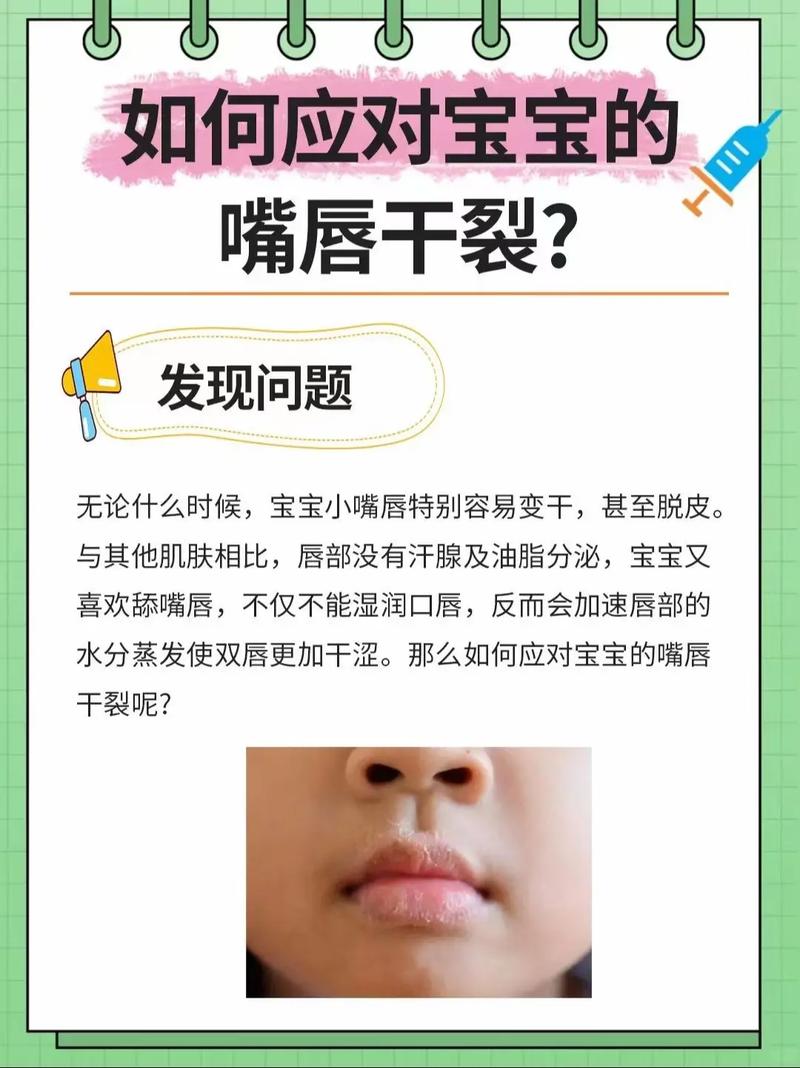儿童嘴唇干裂是缺水、过敏还是疾病信号？家长该如何科学应对？-第1张图片-郑州医学网