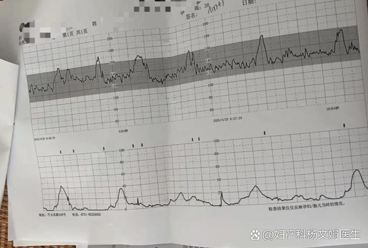孕期刺激乳头真的会导致宫缩吗?对胎儿会有影响吗?-第1张图片-郑州医学网 孕期刺激乳头真的会导致宫缩吗?对胎儿会有影响吗?-第1张图片-郑州医学网