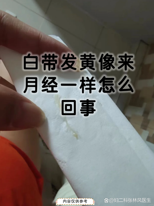 怀孕期间白带发黄又多，是正常现象还是感染信号？-第3张图片-郑州医学网