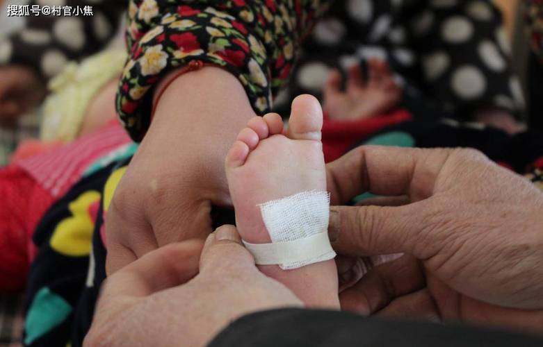 农村合作医疗对新生儿医疗保障的具体覆盖范围和报销标准是怎样的？-第3张图片-郑州医学网