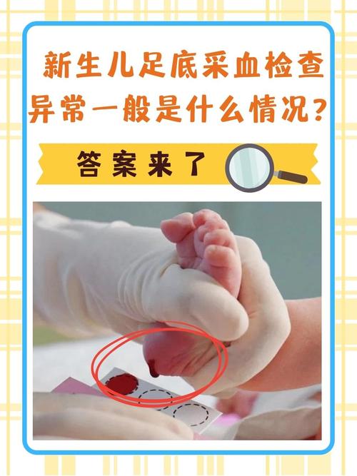 新生儿不采足跟血会影响健康筛查吗？有什么替代方案吗？-第1张图片-郑州医学网