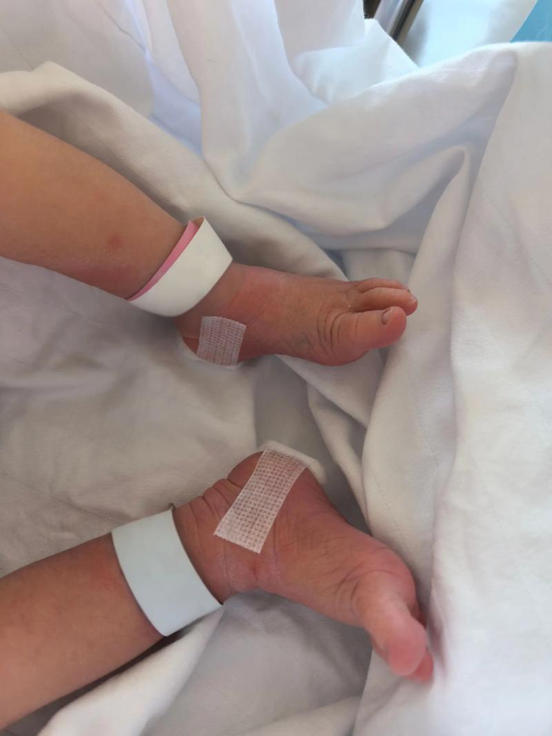 新生儿不采足跟血会影响健康筛查吗？有什么替代方案吗？-第2张图片-郑州医学网