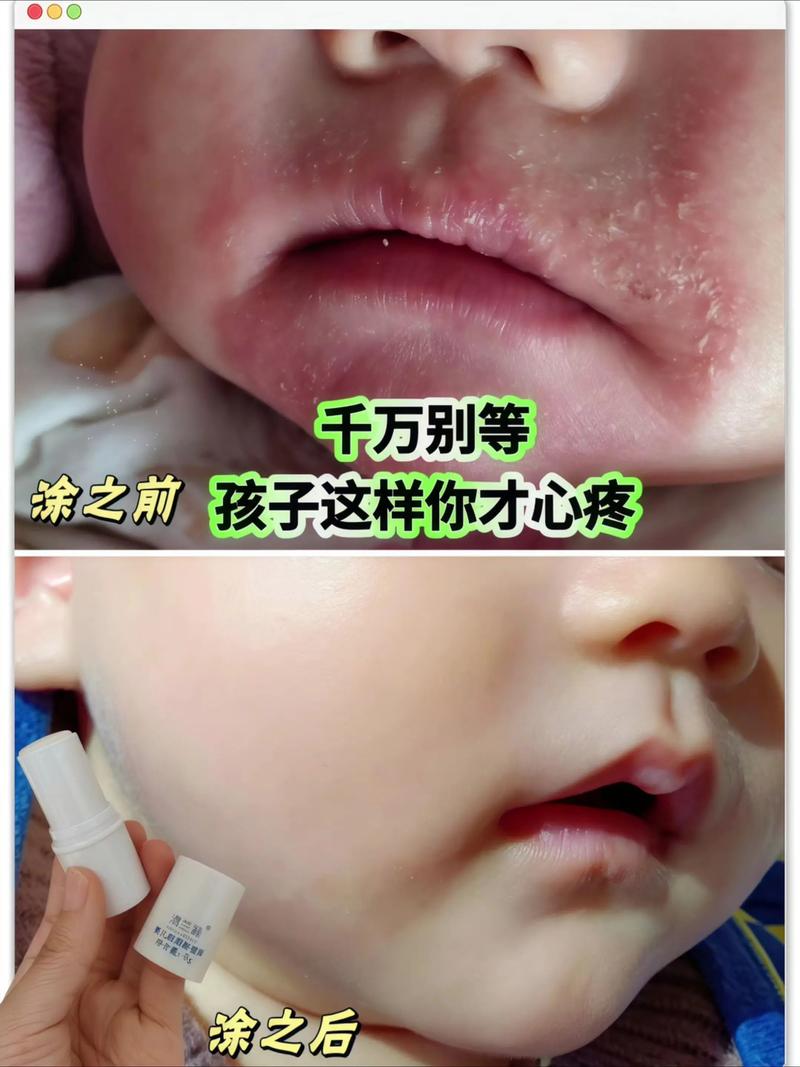 儿童唇膏孕妇能放心用吗？成分安全性和适用性需注意什么？-第1张图片-郑州医学网