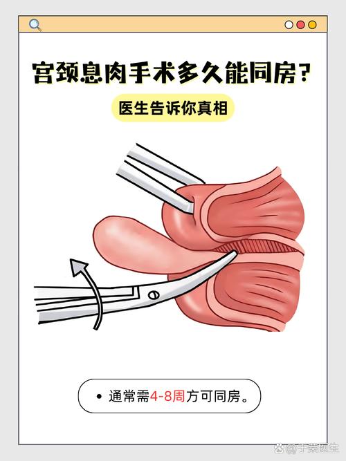 孕期发现宫颈息肉会影响胎儿吗？需要治疗还是等生完再说？-第2张图片-郑州医学网