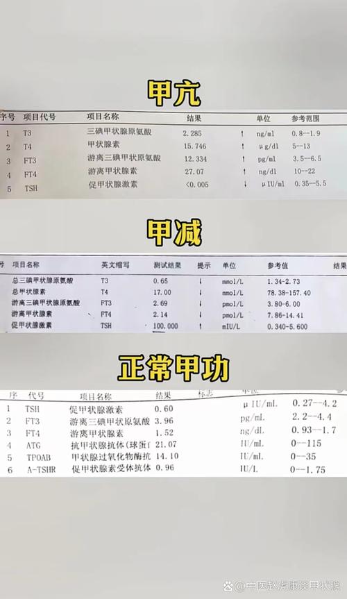 孕期甲亢正常值到底是多少?不同孕期阶段标准有何差异?-第1张图片-郑州医学网 孕期甲亢正常值到底是多少?不同孕期阶段标准有何差异?-第1张图片-郑州医学网