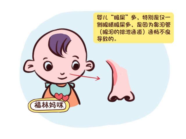 新生儿眼睛分泌物发黄是正常现象还是疾病信号？-第1张图片-郑州医学网