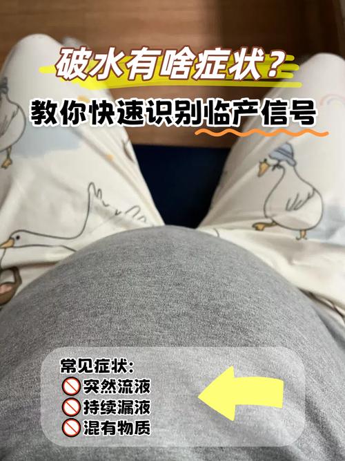 孕期烧心反酸水怎么办？有哪些安全有效的缓解方法？-第2张图片-郑州医学网