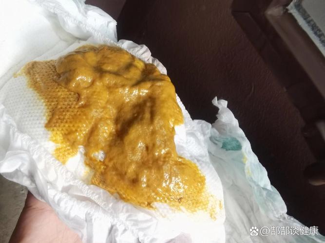 新生儿血里有细菌感染，这究竟是怎么发生的？又该如何应对？-第3张图片-郑州医学网