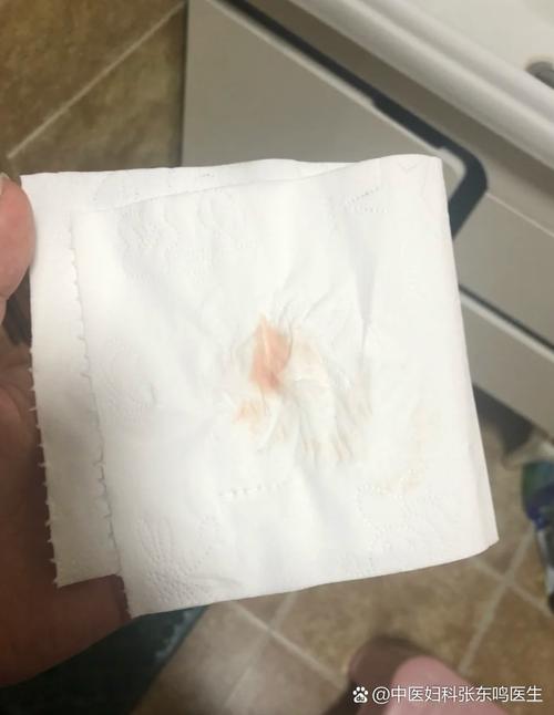 孕期出血量大于月经量是危险信号吗？该如何紧急处理？-第2张图片-郑州医学网