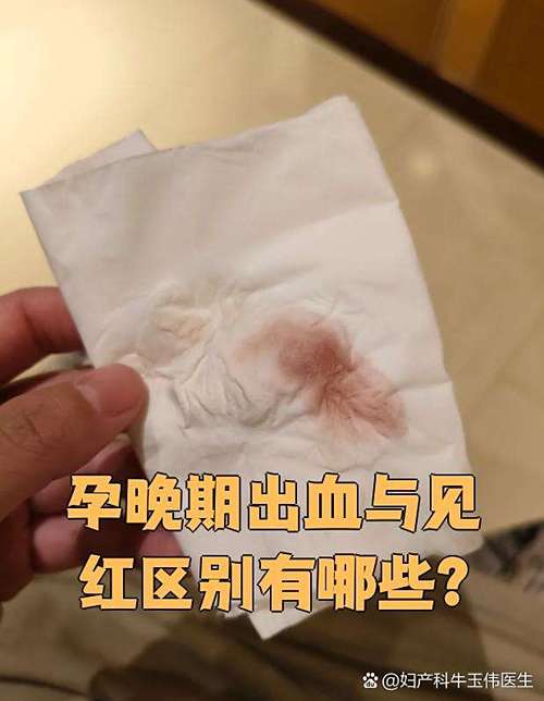 孕期出血量大于月经量是危险信号吗？该如何紧急处理？-第3张图片-郑州医学网