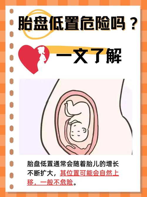 孕期低钾血症究竟会对胎儿造成哪些潜在的健康风险？-第2张图片-郑州医学网