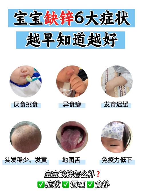 儿童缺锌会有哪些典型症状?家长该如何辨别和应对?-第2张图片-郑州医学网 儿童缺锌会有哪些典型症状?家长该如何辨别和应对?-第2张图片-郑州医学网