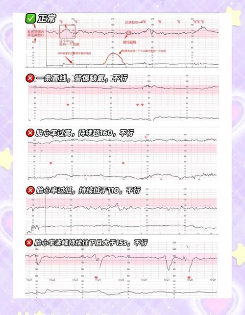 孕期胎心率偏高，胎儿会不会缺氧？需要如何科学处理？-第1张图片-郑州医学网