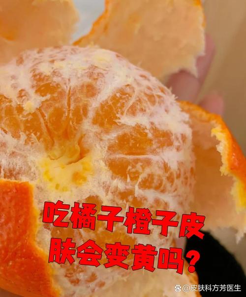孕期吃橙子会导致宝宝皮肤变黄吗?科学依据与真相解析-第1张图片-郑州医学网 孕期吃橙子会导致宝宝皮肤变黄吗?科学依据与真相解析-第1张图片-郑州医学网