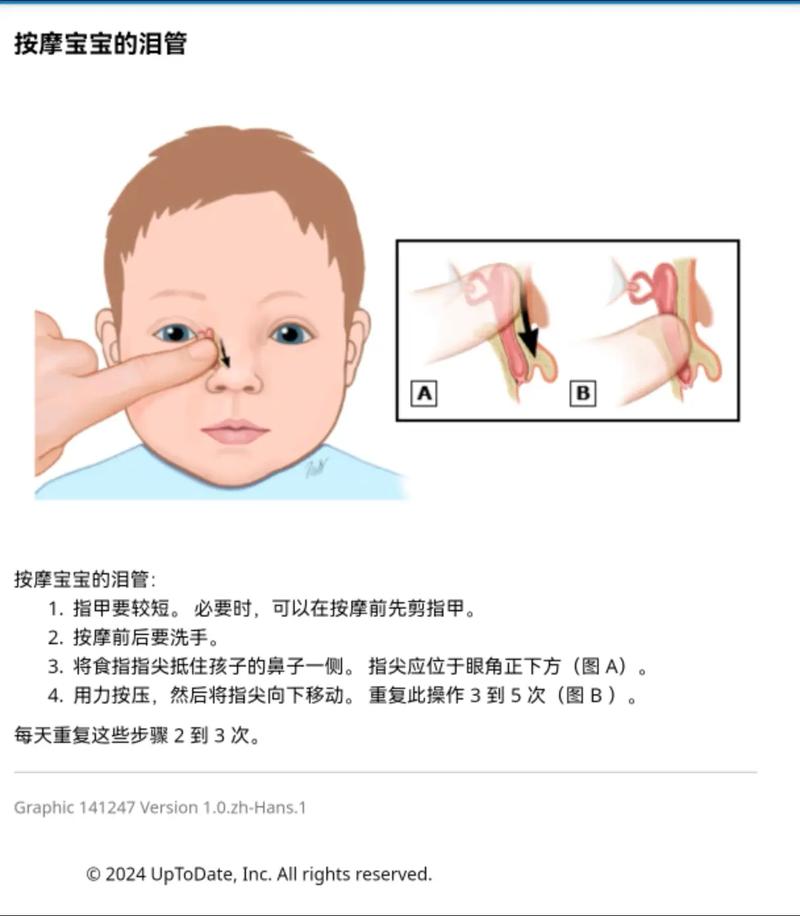 新生儿泪腺炎按摩视频操作手法是否正确?需注意哪些风险事项?-第1张图片-郑州医学网 新生儿泪腺炎按摩视频操作手法是否正确?需注意哪些风险事项?-第1张图片-郑州医学网