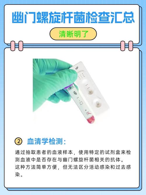 儿童幽门螺杆菌感染有哪些检查方法?各方法适用年龄和注意事项是什么?-第2张图片-郑州医学网 儿童幽门螺杆菌感染有哪些检查方法?各方法适用年龄和注意事项是什么?-第2张图片-郑州医学网